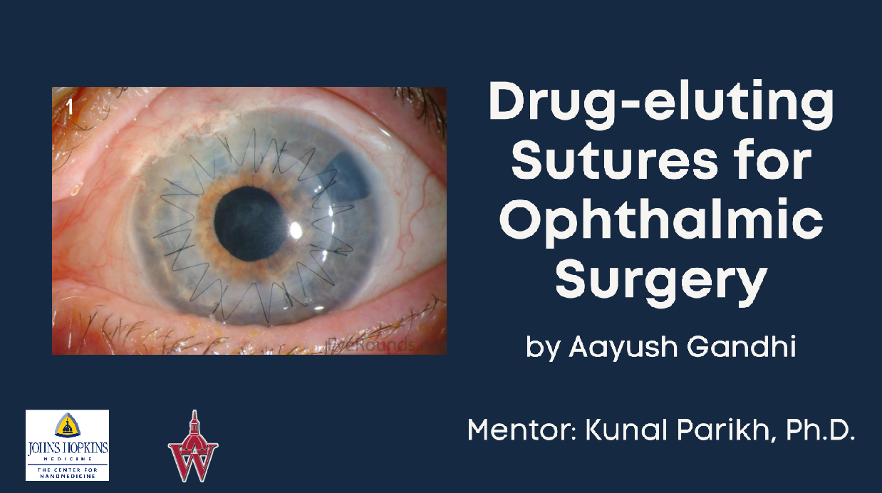 Drug-eluting sutures for Ophthalmic Surgery